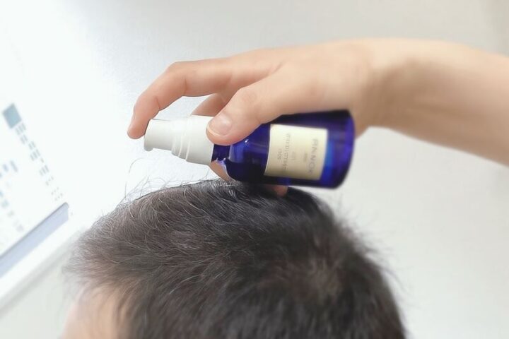 原液100%ヒト幹細胞上清液を<br>深部へ導入
